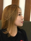 Jaw Reduction, Rhinoplasty and Breast Augmentation in Korea — Korea cost, reviews & before-after | MISOODA