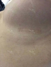 Jaw Reduction, Rhinoplasty and Breast Augmentation in Korea — Korea cost, reviews & before-after | MISOODA