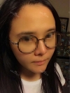 Hairline, Incision Hair transplantation. — Korea cost, reviews & before-after | MISOODA