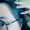 Hairline, Incision Hair transplantation. — Korea cost, reviews & before-after | MISOODA