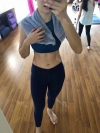 Finally did liposuction! — Korea cost, reviews & before-after | MISOODA