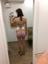 Finally did liposuction! — Korea cost, reviews & before-after | MISOODA
