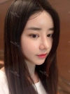 After 5 months of nose surgery — Korea cost, reviews & before-after | MISOODA