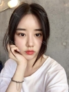 After 5 months of nose surgery — Korea cost, reviews & before-after | MISOODA