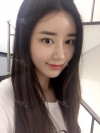 After 5 months of nose surgery — Korea cost, reviews & before-after | MISOODA