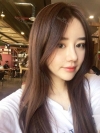 After 5 months of nose surgery — Korea cost, reviews & before-after | MISOODA