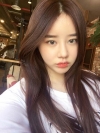 After 5 months of nose surgery — Korea cost, reviews & before-after | MISOODA