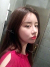 After 5 months of nose surgery — Korea cost, reviews & before-after | MISOODA