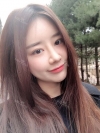 After 5 months of nose surgery — Korea cost, reviews & before-after | MISOODA