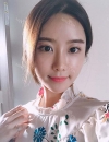 After 3 months of Eye, Nose, Fat grafting Surgery — Korea cost, reviews & before-after | MISOODA
