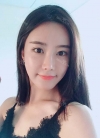 After 3 months of Eye, Nose, Fat grafting Surgery — Korea cost, reviews & before-after | MISOODA