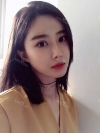 After 3 months of Eye, Nose, Fat grafting Surgery — Korea cost, reviews & before-after | MISOODA