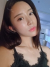 After 3 months of Eye, Nose, Fat grafting Surgery — Korea cost, reviews & before-after | MISOODA