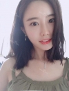 After 3 months of Eye, Nose, Fat grafting Surgery — Korea cost, reviews & before-after | MISOODA