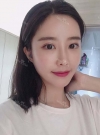 After 3 months of Eye, Nose, Fat grafting Surgery — Korea cost, reviews & before-after | MISOODA
