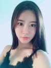 After 3 months of Eye, Nose, Fat grafting Surgery — Korea cost, reviews & before-after | MISOODA