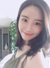 After 3 months of Eye, Nose, Fat grafting Surgery — Korea cost, reviews & before-after | MISOODA