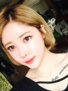 After 3 months of Eye, Nose Fat Grafting Surgery! — Korea cost, reviews & before-after | MISOODA