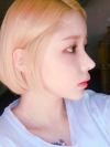 After 3 months of Eye, Nose Fat Grafting Surgery! — Korea cost, reviews & before-after | MISOODA