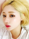 After 3 months of Eye, Nose Fat Grafting Surgery! — Korea cost, reviews & before-after | MISOODA