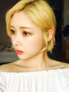 After 3 months of Eye, Nose Fat Grafting Surgery! — Korea cost, reviews & before-after | MISOODA
