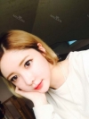 After 3 months of Eye, Nose Fat Grafting Surgery! — Korea cost, reviews & before-after | MISOODA