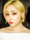 After 3 months of Eye, Nose Fat Grafting Surgery! — Korea cost, reviews & before-after | MISOODA