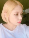 After 3 months of Eye, Nose Fat Grafting Surgery! — Korea cost, reviews & before-after | MISOODA