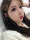 After 3 months of Eye, Nose Fat Grafting Surgery! — Korea cost, reviews & before-after | MISOODA