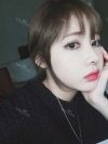 After 3 months of Eye, Nose Fat Grafting Surgery! — Korea cost, reviews & before-after | MISOODA