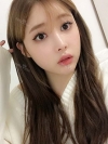 After 3 months of Eye, Nose Fat Grafting Surgery! — Korea cost, reviews & before-after | MISOODA