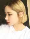 After 3 months of Eye, Nose Fat Grafting Surgery! — Korea cost, reviews & before-after | MISOODA
