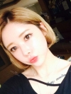 After 3 months of Eye, Nose Fat Grafting Surgery! — Korea cost, reviews & before-after | MISOODA
