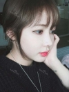 After 3 months of Eye, Nose Fat Grafting Surgery! — Korea cost, reviews & before-after | MISOODA