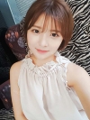 After 6 months of Eye, Nose, Fat grafting Surgery — Korea cost, reviews & before-after | MISOODA
