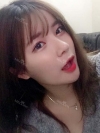 After 6 months of Eye, Nose, Fat grafting Surgery — Korea cost, reviews & before-after | MISOODA