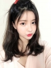 After 6 months of Eye, Nose, Fat grafting Surgery — Korea cost, reviews & before-after | MISOODA