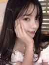 After 6 months of Eye, Nose, Fat grafting Surgery — Korea cost, reviews & before-after | MISOODA