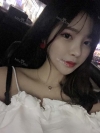 After 6 months of Eye, Nose, Fat grafting Surgery — Korea cost, reviews & before-after | MISOODA