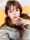After 6 months of Eye, Nose, Fat grafting Surgery — Korea cost, reviews & before-after | MISOODA