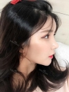 After 6 months of Eye, Nose, Fat grafting Surgery — Korea cost, reviews & before-after | MISOODA