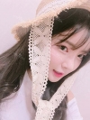 After 6 months of Eye, Nose, Fat grafting Surgery — Korea cost, reviews & before-after | MISOODA