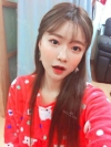 After 6 months of Eye, Nose, Fat grafting Surgery — Korea cost, reviews & before-after | MISOODA