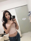 After 6 months of Eye, Breast, Fat grafting Surgery — Korea cost, reviews & before-after | MISOODA