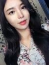 After 6 months of Eye, Breast, Fat grafting Surgery — Korea cost, reviews & before-after | MISOODA