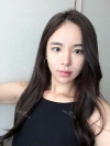 After 6 months of Eye, Breast, Fat grafting Surgery — Korea cost, reviews & before-after | MISOODA