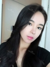 After 6 months of Eye, Breast, Fat grafting Surgery — Korea cost, reviews & before-after | MISOODA