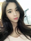 After 6 months of Eye, Breast, Fat grafting Surgery — Korea cost, reviews & before-after | MISOODA