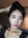 After 6 months of Eye, Breast, Fat grafting Surgery — Korea cost, reviews & before-after | MISOODA