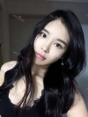 After 6 months of Eye, Breast, Fat grafting Surgery — Korea cost, reviews & before-after | MISOODA
